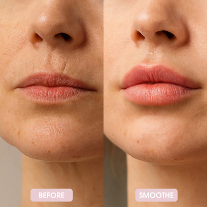 Smoothe Skin Care Microneedling System